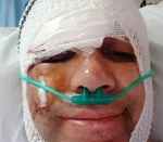 امیر کربلایی‌زاده در راه منزل تصادف و در بیمارستان بستری شد 4